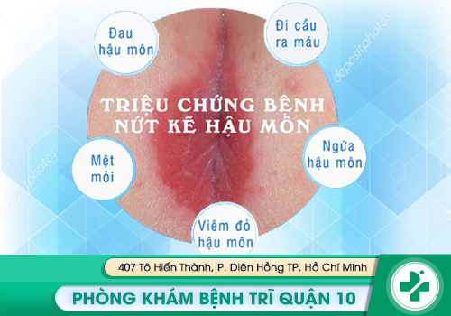 Triệu chứng của nứt kẻ hậu môn